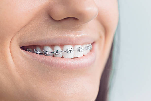 Best Full Mouth Reconstruction  in Edgewood, WA